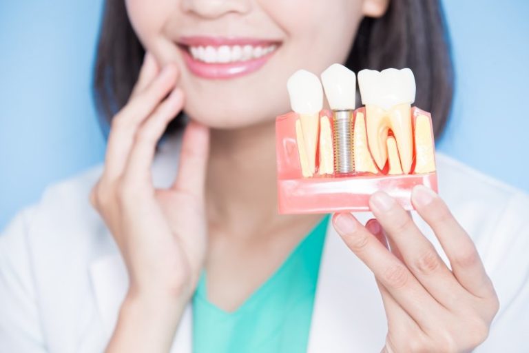 Characteristics of an Ideal Dental Implant Candidate | Dr. LJ Adam